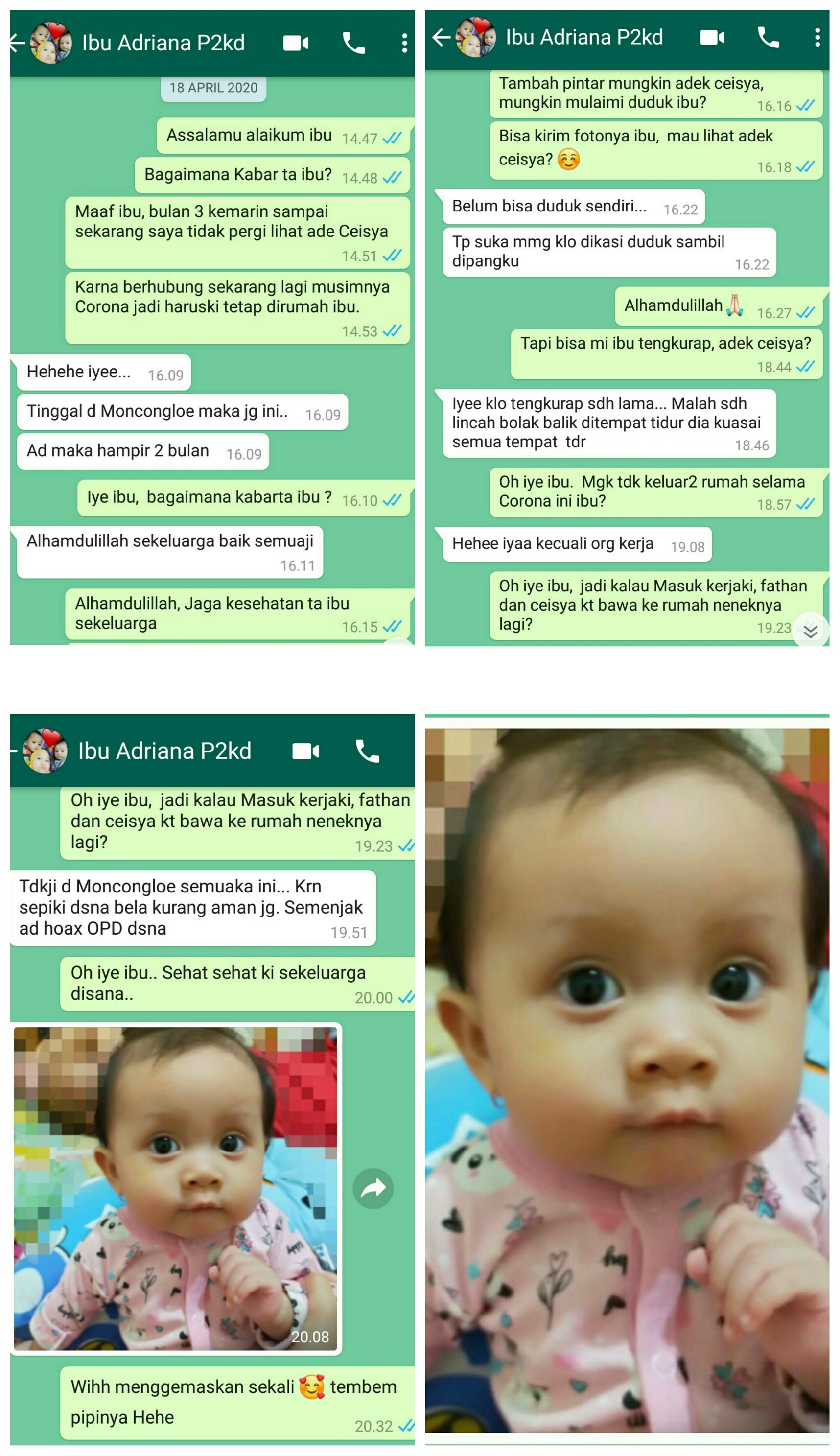 Perkembangan Adek Putri Ceisya Inshiraah
