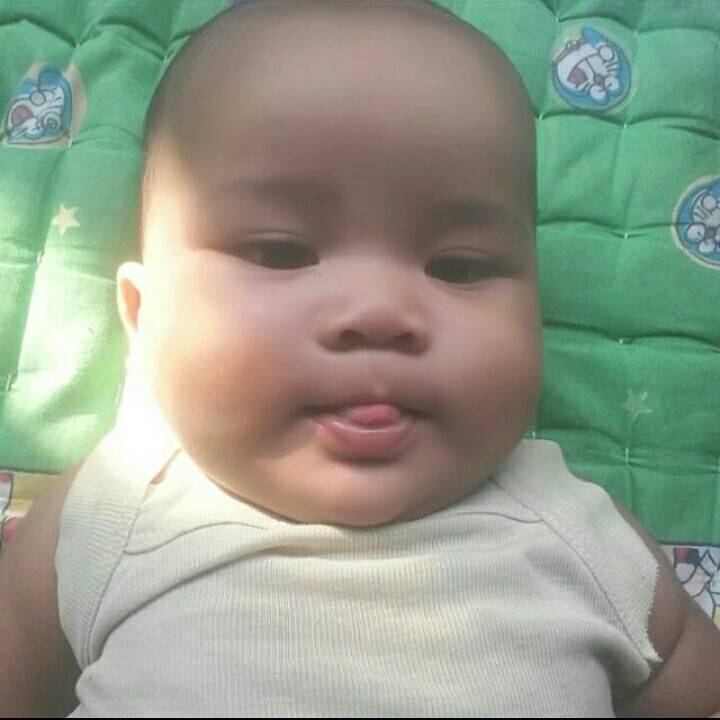 Kondisi Adik Ahmad Arafah
